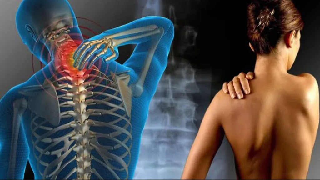 Fibromialgia: pontos dolorosos em vários locais do corpo